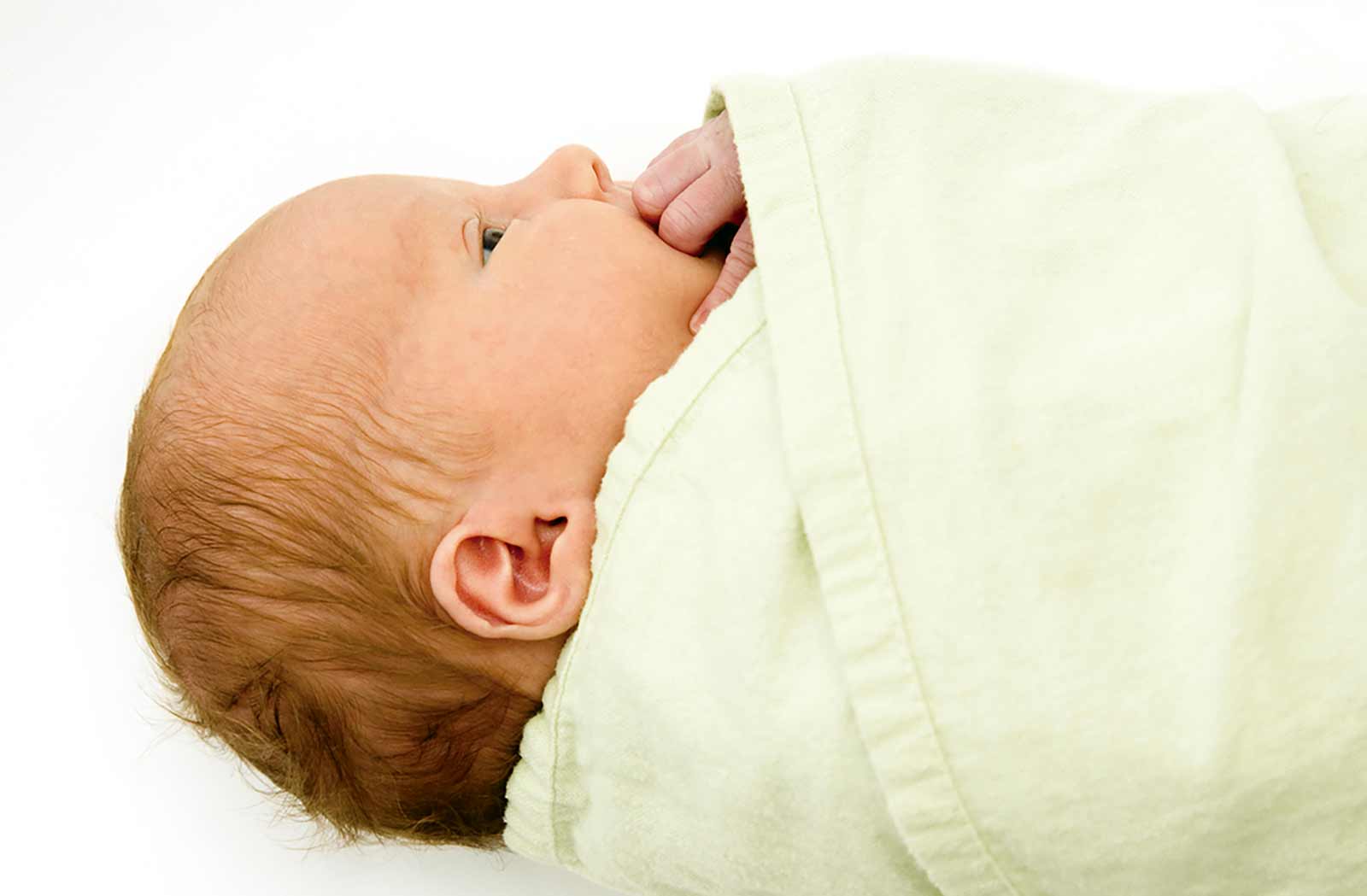 Ictericia en recién nacidos: ¿Por qué mi bebé se puso amarillito?